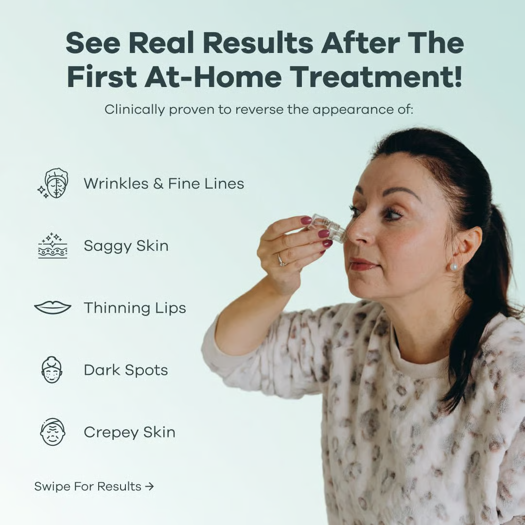 The Senofusion™ System (2 per/ Month)
